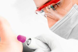 Cappucci Abrasivi per Pedicure - Lukas