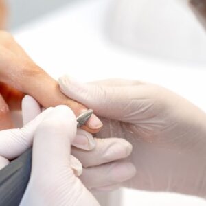 Punta Fresa Rimozione